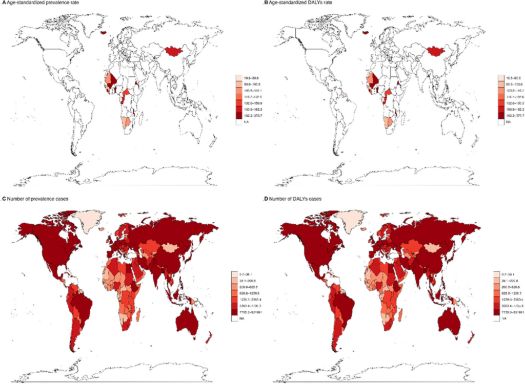 Global leukemia burden and trends: a comprehensive analysis of temporal and spatial variations from 1990—2021 using GBD (Global Burden of Disease) data