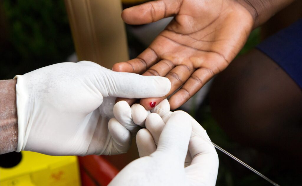 Malaria Surge in Southern Africa