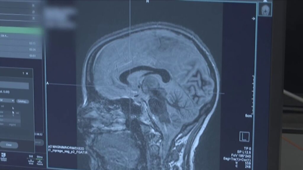 New technology offers hope for Parkinson’s patients