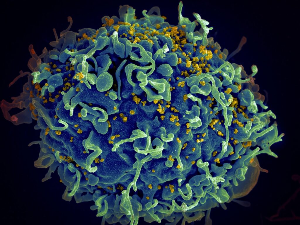Oxford Population Health: Global study of HIV variants underscores challenges for vaccine development